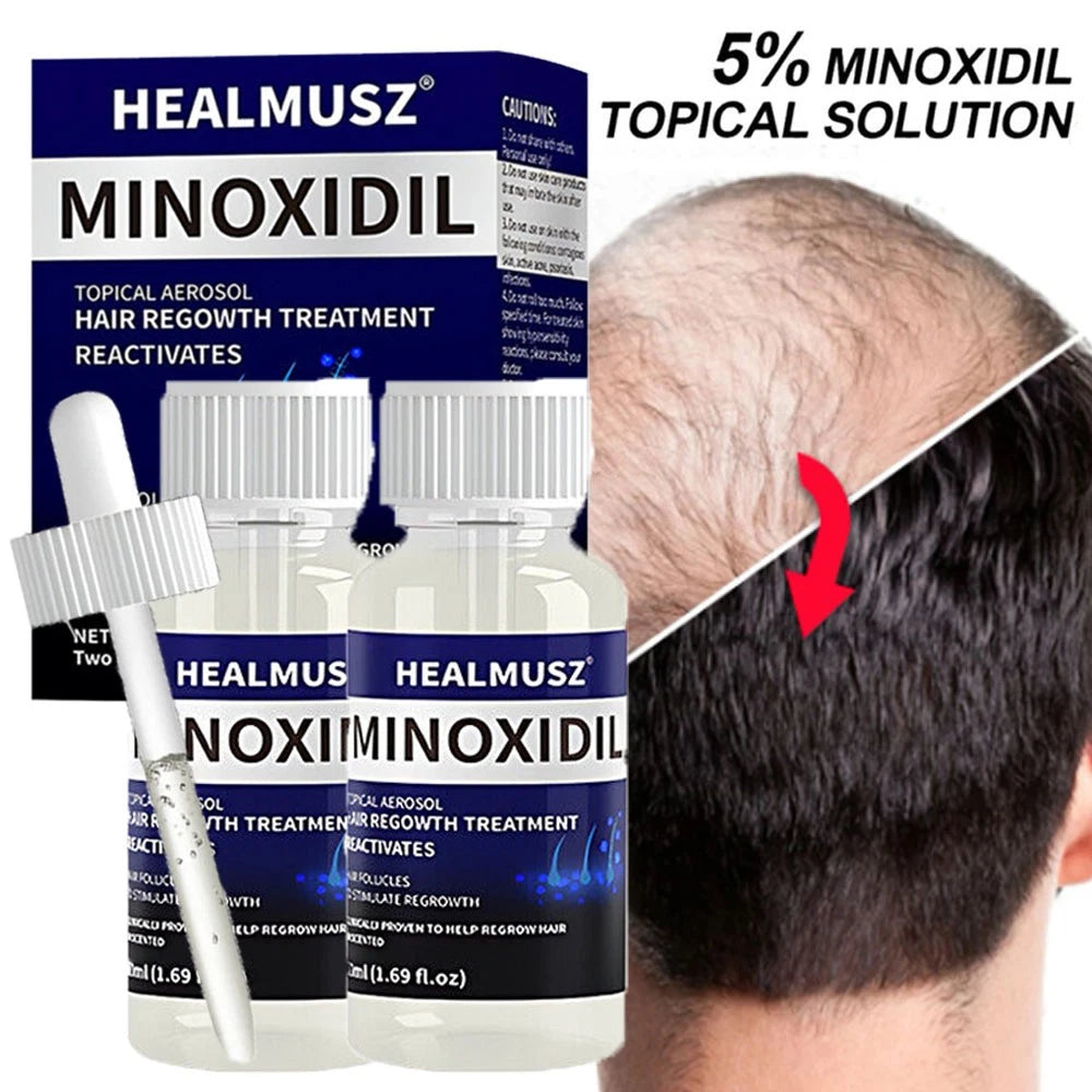 Topical Minoxidil 5%